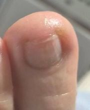 PodoAkitve Berlin Bild 6