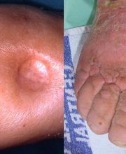 Consulta Barreiro-Vascular (Drs. A. Barreiro Mouro y J. Barreiro Veiguela) imagen 17