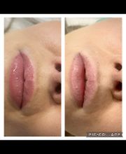 Dinastétique esthéticienne visagiste dermographe image 11