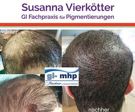 Microhaar Verdichtung 21-