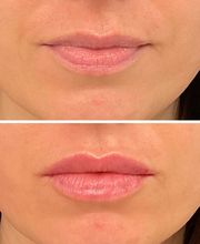 LivingYoung Center for Health & Anti-Aging image 20