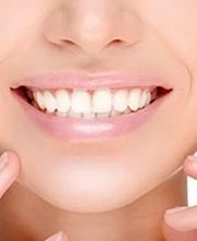 Neo Smiles Dental image 5