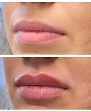 Blush Med Spa image 19