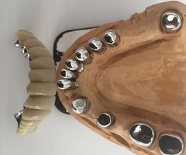 Dentaltechnik Oriwal Bild 9