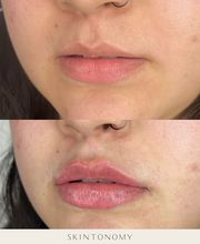 Skintonomy Medical Spa image 15