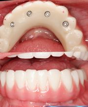 Northeast Lincoln Family Dentistry image 7