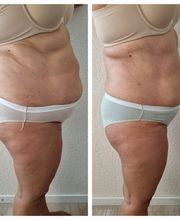 Therapie Serra Massage Bild 6