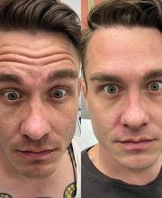 Juvenalia Brío | Botox, Hydrafacial & Ultraformer - Condesa / Roma Norte CDMX imagen 11