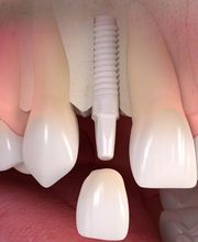 Dr.med. dent. Markus Zaruba Bild 5