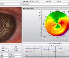 Muller Janz Opticiens Bild 13