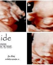 See Baby Ecografía Emocional imagen 12