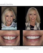 The Dental Design Center - Cosmetic, Implant & General Dentistry image 15