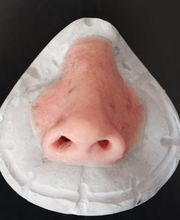 Kornelius Egner Epithetik Bild 5