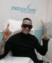 ENDLICH OHNE Tattooentfernung Filiale Kassel Bild 12