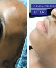 dermani MEDSPA Granger image 5