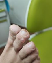 Podología clínica y deportiva Sureste imagen 9