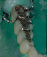 Dr méd. dent. Möller Peter Bild 2