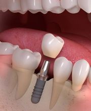 Dr.med. dent. Markus Zaruba Bild 3