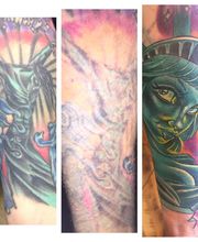 Removery Tattoo Removal & Fading image 1