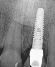 Draper Dental image 8