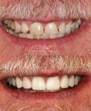 Metro Smiles P.C. image 4