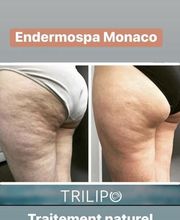 Endermospa image 2