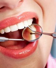 Zahnarzt Zürich Dr. Bahri Adis I Dentalhygiene & Zahnimplantate Zürich I Bleaching Bild 1