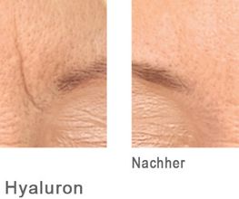 Aesthetic Dream by Dr. Cyrus Moghaddam Privatpraxis für Ästhetische Medizin & Kosmetische Chirurgie Bild 12