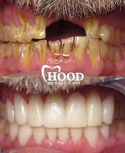 Hood Dental Care - Watson Office image 5