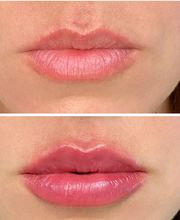 LivingYoung Center for Health & Anti-Aging image 15