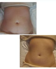 VitalmassageSevilla imagen 2