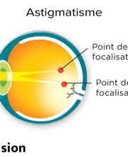 Aixel Vision image 3