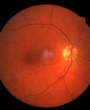 Fleury Opticiens SA Bild 9