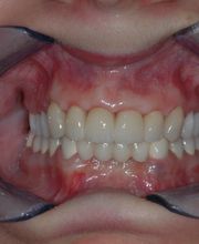 Bodensee Implantatzentrum Dr. Wolfgang Prinz MDSc Zahnarzt/ Implantologie Bild 6