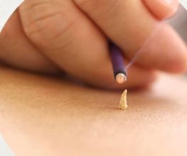 Acupuncture Pascale Savey image 1