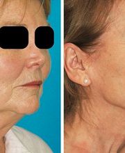 Eugenie Brunner, MD, FACS image 5