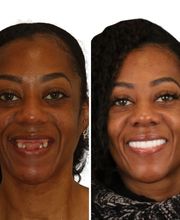 Britely Dentures + Implants Studio image 11