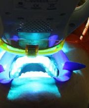 centre-odontologia-miret-puig-blanqueamiento-dental-02.jpg