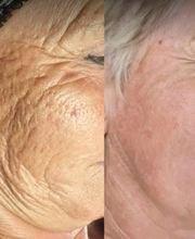 Wrinkle Free WA image 15