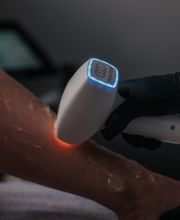 Haarentfernung mit Diodenlaser in Remscheid Wuppertal Solingen