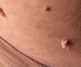 abdermatologia imagen 2