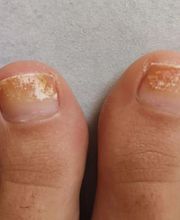 Podología clínica y deportiva Sureste imagen 11