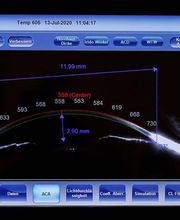 Optik Scheffer Essen