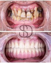 Supreme Dental Clinic imagen 12