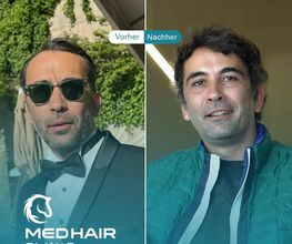 MedHair Clinic | Haartransplantationen in der Türkei Istanbul Bild 14