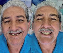 Aniceto Odontologia imagen 15