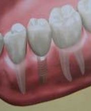 Clínica Implanteoral Milladoiro imagen 13