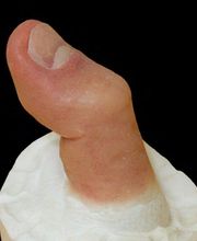 Kornelius Egner Epithetik Bild 4