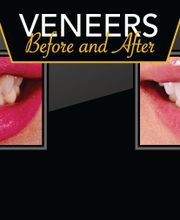 Northeast Lincoln Family Dentistry image 11