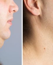Bodystyl - anders - schlank Bild 4